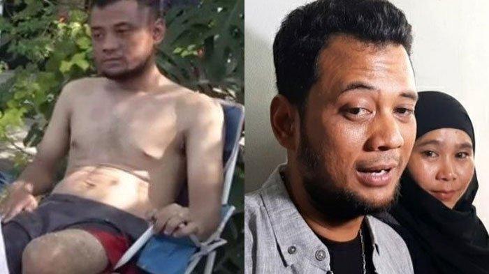 Panji Petualang ungkap penyakit lain yang juga diderita selain diabetes kering