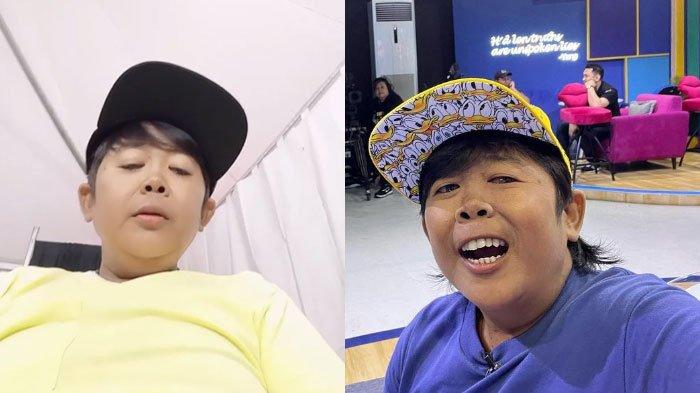 Pelawak Adul yang kini mengalami kebutaan akibat penyakit glaukoma