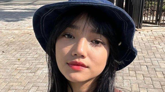 Fuji ungkap keinginannya oplas hidung.