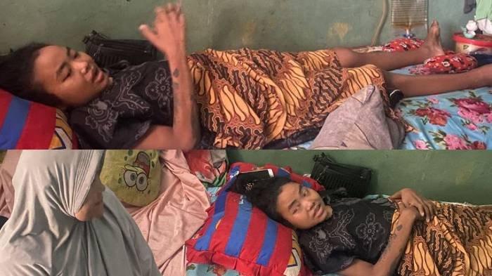 LUMPUH USAI CAESAR - Ratih Raynada (30) kini hanya mampu berbaring di atas kasur seusai tubuhnya lumpuh karena operasi caesar anak keempatnya di RSUD dr Chasbullah Abdulmadjid, Kota Bekasi, pada September 2024.