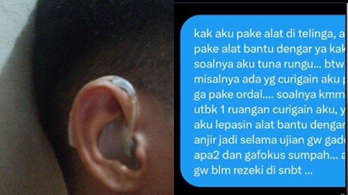 Cuitan peserta SNBT 2024 yang tunarungu tapi diminta melepas alat bantu dengar saat tes di Universitas Indonesia (UI)