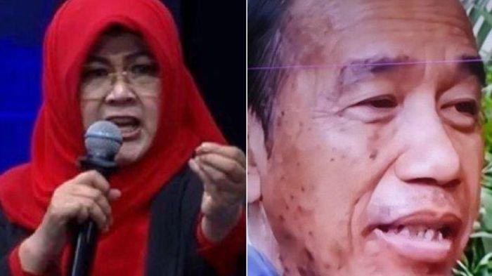 KONDISI KESEHATAN JOKOWI - Pernyataan Dokter Tifa (foto kiri) tentang kondisi kesehatan Jokowi, jadi sorotan. Bintik hitam di wajah Presiden Ke-7 RI (foto kanan) dikira karena autoimun.