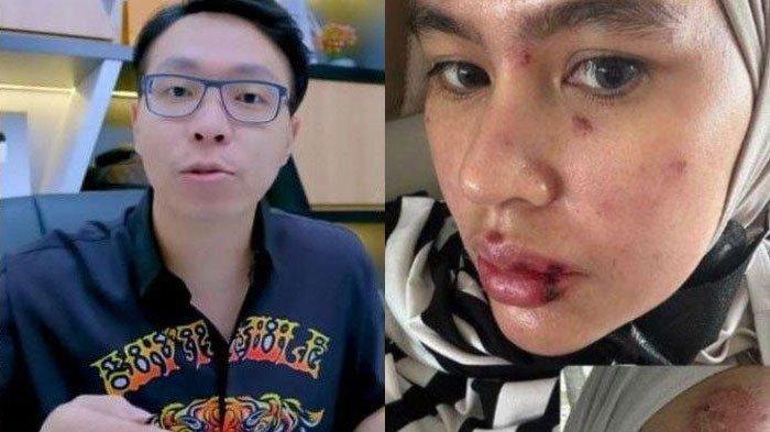Kolase foto dr Richard Lee dan Kartika Putri.