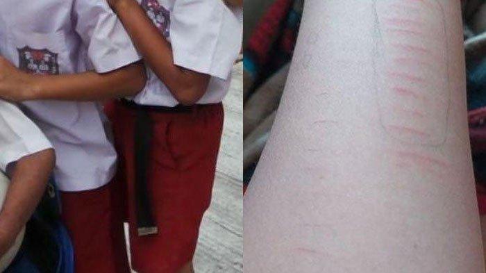 Fenomena 11 siswa SD di Situbondo sayat tangan sendiri jadi perhatian Kepsek dan Polsek