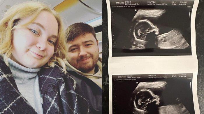 Jess Smith (aktris pemeran matahari di Teletubbies), Ricky Latham kekasihnya, dan hasil foto USG anak pertama mereka.