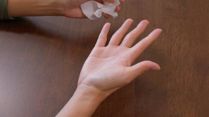 Ilustrasi hiperhidrosis