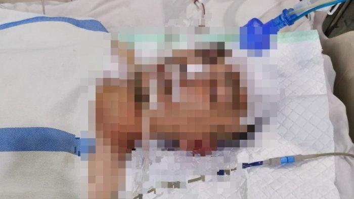 Satu minggu menjalani perawatan intensif di RSUD A.W. Sjahranie Samarinda, Rio Trisna Ramadhani (28), sopir korban pengeroyokan dikabarkan masih dalam keadaan koma, Rabu (19/7/2023).