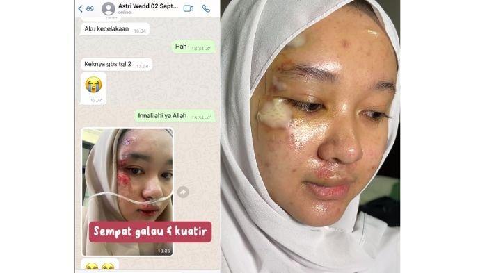 Curhatan pengantin wanita Balikpapan kepada MUA yang H-3 menikah mengalami kecelakaan.