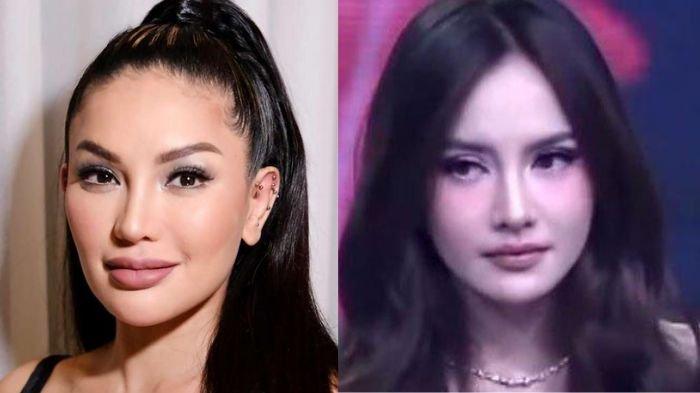 Nikita Mirzani (kiri) dan Mahalini usai operasi hidung (kanan). Nikita Mirzani diduga sindir istri Rizky Febian yang operasi hidung dengan dalih penyakit sinus.