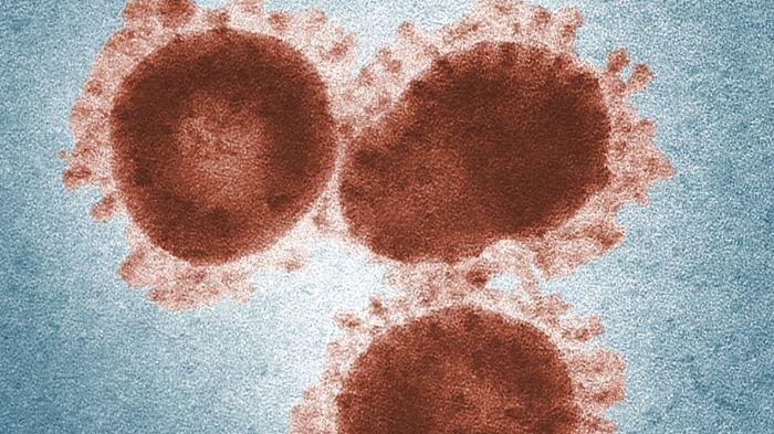 ILUSTRASI VIRUS CORONA SARS - Inilah Sejarah 12 Maret merupakan pertama kalinya WHO mengeluarkan peringatan terjadinya pandemi SARS di dunia, penyakit menular virus corona.