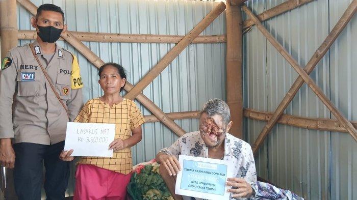 KUNJUNG - PS. Kasidokkes Polres Manggarai Timur, Bripka Heribertus A.B.Tena, S.Tr.AK.,M.Si saat mengunjungi Lasarus Mei, penderita kanker kulit di di Kampung Ting Tuke, Desa Satar Ngkeling, Rabu 4 Juni 2025 kemarin.