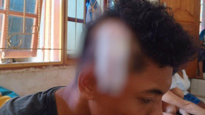 RG (18), pelajar salah satu SMKN di Kabupaten Manggarai Barat, dikeroyok dan mengalami luka bacok adi kepalanya. Kejadian ini terjadi di Puncak Waringin Labuan Bajo, Mabar.