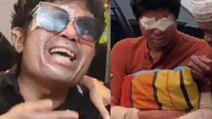 Agus Salim, korban penyiraman air keras yang kini viral di media sosial. Digugat donatur hingga minta donasi 7 turunan.