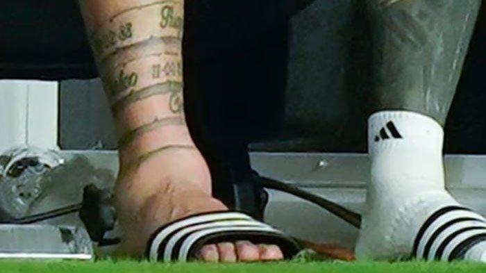 Kondisi kaki Lionel Messi yang cedera.
