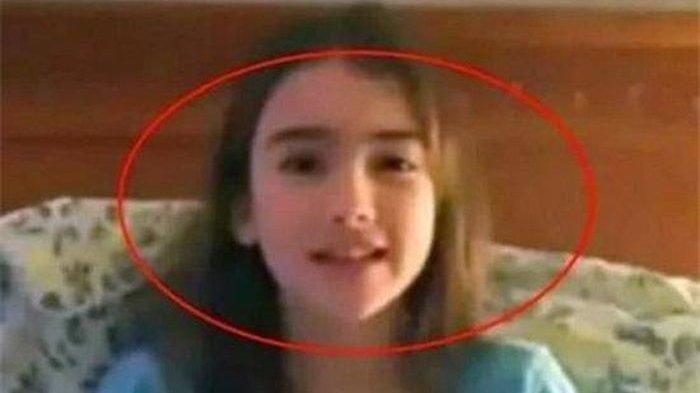 Penampilan Amelia Taylor sekarang. Bayi terkecil di dunia, tumbuh menjadi gadis yang cantik 15 tahun kemudian.