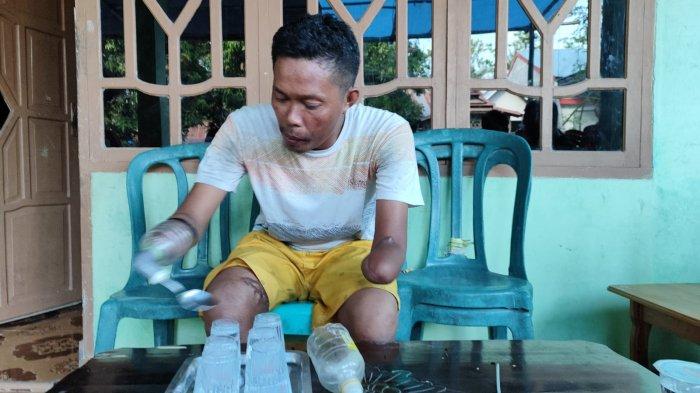 Indrawansyah warga asal Dusun Ulu Tedong, Desa Garanta, Kecamatan Ujung Loe, Kabupaten Bulukumba, Sulawesi Selatan. Ia pakai lengan artifisial akibat kecelakaan kerja 2021 lalu.