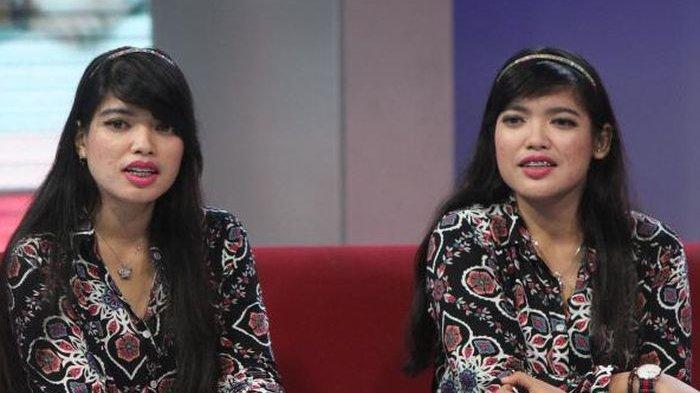 Yuliana dan Yuliani, kembar siam pertamdi Indonesia yang berhasil dipisahkan.