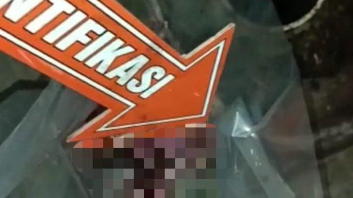 Janin manusia yang ditemukan di toilet Rumah Sakit Awaloei, Minahasa, Sulawesi Utara.