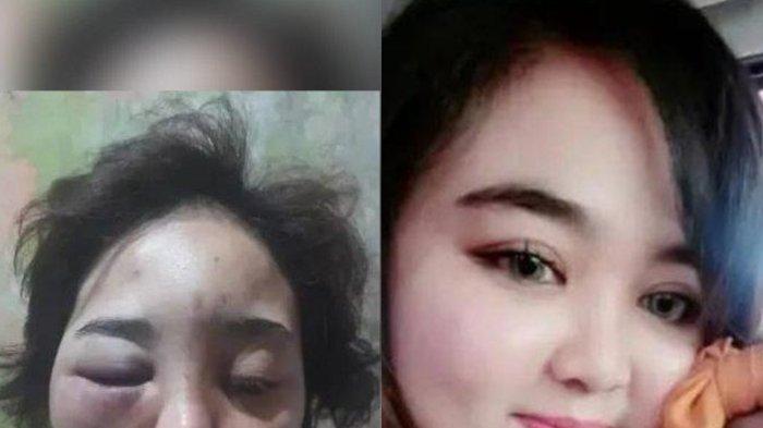 BERUBAH - Foto sesudahan sebelum DA mengalami penganiayaan.