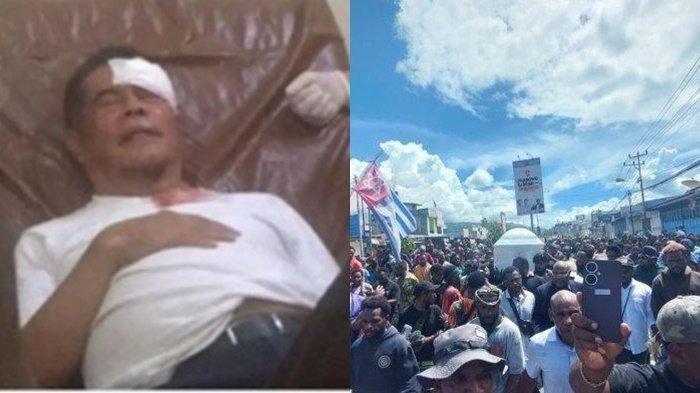 Pj Gubernur Ridwan Rumasukun terluka kena lemparan batu saat iring-iringan jenazah Lukas Enembe.