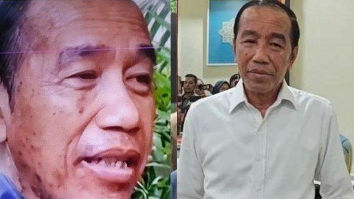 KONDISI KESEHATAN JOKOWI - Presiden ke-7, Joko Widodo (Jokowi) saat ditemui di kediamannya di Solo, Jumat (13/6/2025). Setelah ramai soal terkena alergi, penampilan terbaru Jokowi dan kondisi kesehatannya kembali menjadi sorotan.