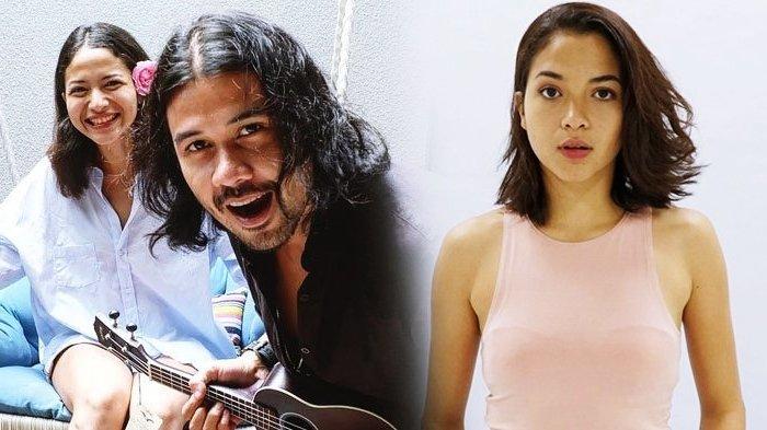 Alami Cedera Tulang Belakang Putri Marino Tak Mau Masuk Rumah Sakit