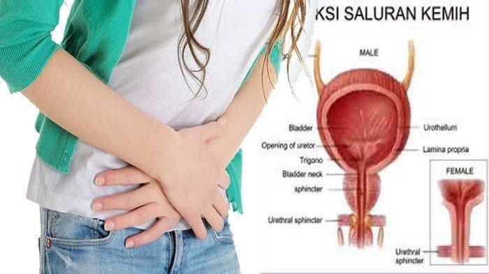 Kenali penyebab Infeksi Saluran Kandung Kemih
