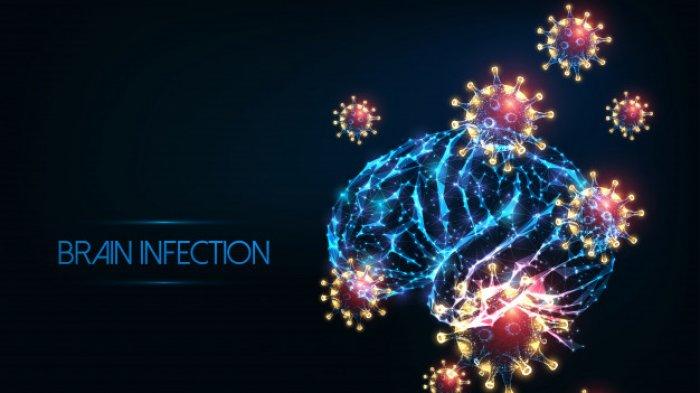 Ilustrasi meningitis.