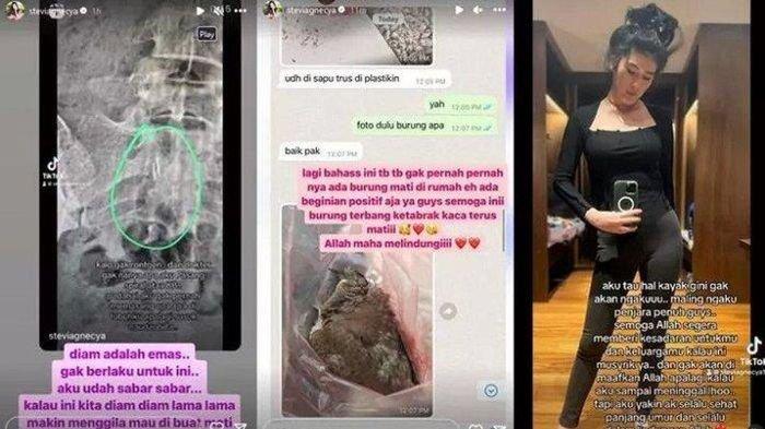 Ada Hal Janggal, Begini Foto Rontgen Stevie Agnecya, Sempat Curiga Disantet Sebelum Meninggal