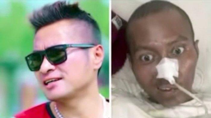 PENYANYI Batak Arul Gurning Meninggal Dunia, Dikenal karena Lagu Dj Batak Remix Boru Batak Nauli. (FB)