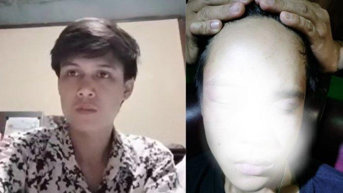 Pemuda di Bengkulu Bonyok Dianiaya Oknum Polisi