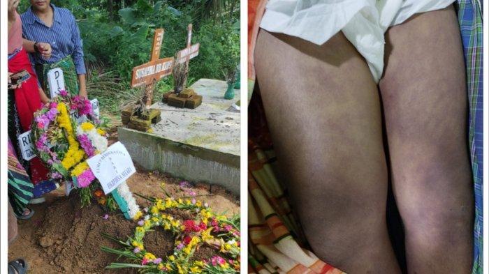 Rindu Syahputra Sinaga (14) meninggal dunia pada Kamis (26/9/2024), setelah menjalani perawatan selama seminggu atas sakit yang dirasakan usai dihukum squat jump 100 kali di sekolah oleh gurunya Selli Winda Hutapea.(TRIBUN MEDAN)