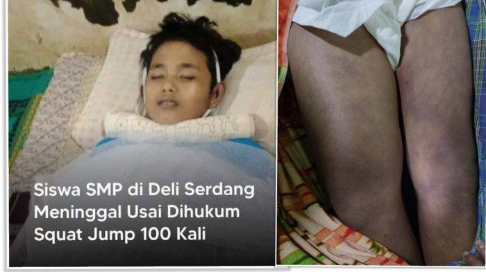 Viral Kematian Siswa SMP Rindu Syahputra Sinaga (14), setelah Sempat Dirawat karena Sakit Gara-gara Dihukum Squat Jump 100 Kali oleh Gurunya di Sekolah SMPN 1 STM Hilir. (Facebook)