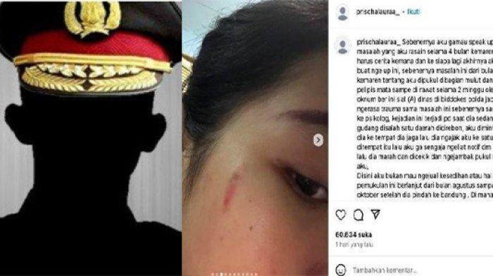 SOSOK Bripda AA Oknum Polisi Jabar Aniaya Wanita hingga Babak Belur Gegara Notifikasi DM Instagram