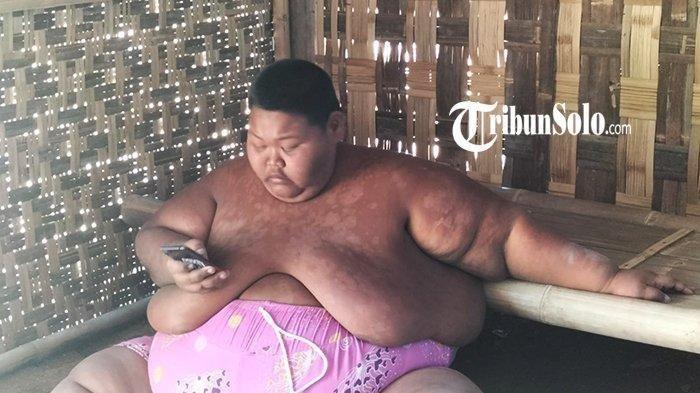 Sungadi (25), pria obesitas warga Desa Sono, Kecamatan Mondokan, Kabupaten Sragen.