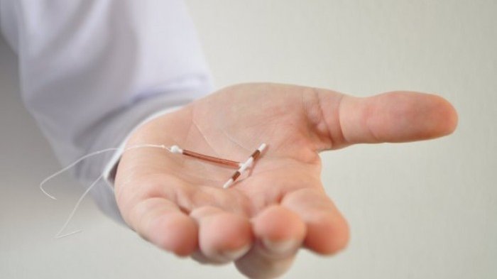 Alat kontrasepsi IUD merek Mirena
