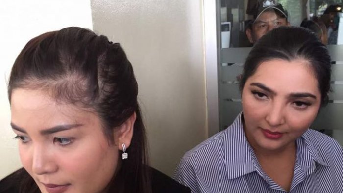 Ashanty dan Nindy Ayunda menjenguk artis peran Julia Perez di Rumah Sakit Cipto Mangunkusumo (RSCM), Jakarta Pusat, Sabtu (22/4/2017).