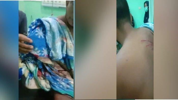 Tangan Arjo (33) putus usai diterkam buaya, Jumat (5/1/2024)