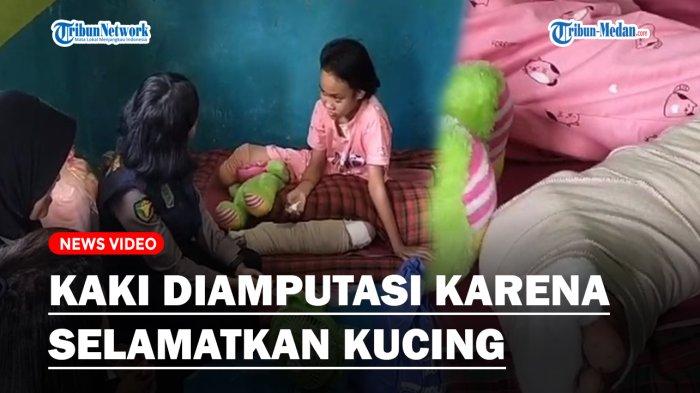 Seorang bocah perempuan bernama Nabila Febrianti(12) rela kehilangan satu kakinya karena mengalami kecelakaan saat menyelamatkan seekor kucing yang hendak tertabrak oleh trik pengangkut semen di Jalan Lintas Negeri Lama, Kecamatan Bilah Hilir, Kabupaten Labuhanbatu, Selasa (8/8/2023).