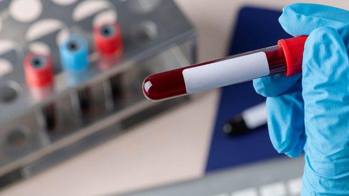 Foto ilustrasi tes DNA
