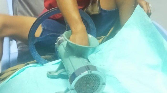 Petugas pada saat melakukan proses pelepasan tangan seorang pasien yang masuk ke dalam mesin penggiling daging di RSUP M Djamil Padang, Selasa (28/1/2025).