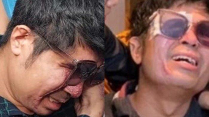 Kondisi Agus Salim, Agus Salim Akhirnya Ungkap Kondisi Matanya, Makin Buruk Dua-duanya