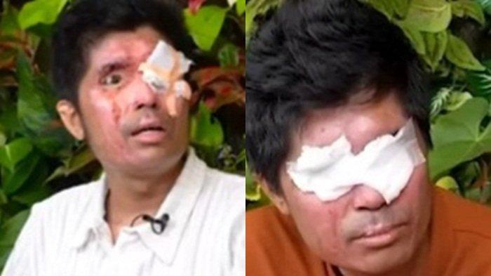 Agus Salim, Tutupi Mata Pakai Kacamata, Agus Salim Keceplosan Tahu Kondisi Lawan Bicara