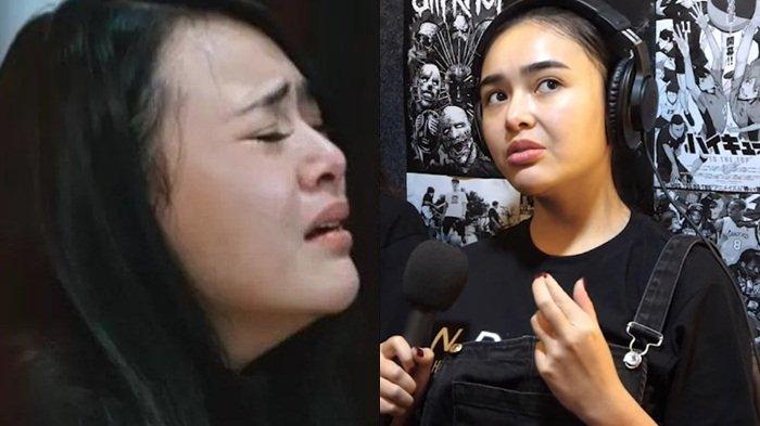 Amanda Manopo ungkap derita sakit parah di bagian otak, sering tumbang saat kelelahan.