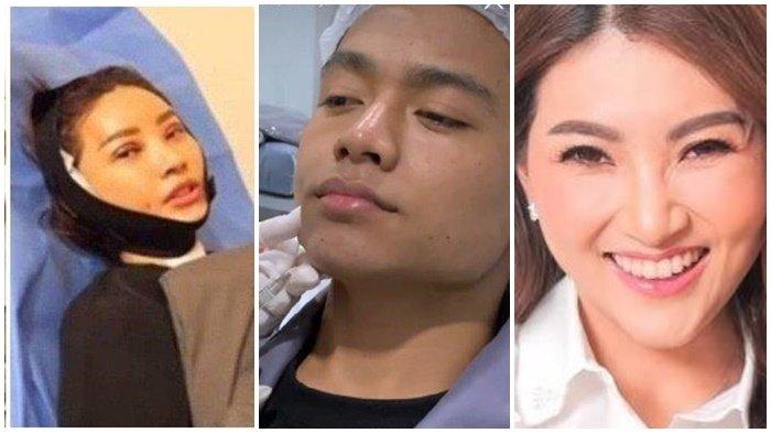 Artis Betrand Peto mulai mengikuti jejak Sarwendah untuk melakukan operasi plastik.