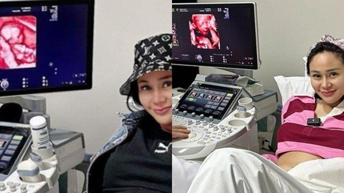 Belum Juga Melahirkan Denise Chariesta Sudah Rencanakan Hamil Lagi
