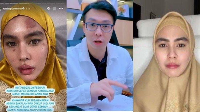 Diduga skakmat Kartika Putri, video lawas dr Richard Lee jadi sorotan.