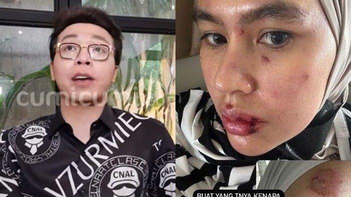 Ditertawakan Richard Lee, Kartika Putri Tahan Malu Disentil soal Azab