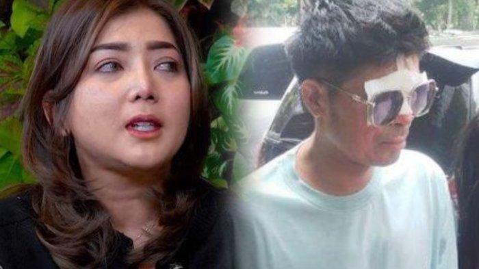 Gelagat Agus Datangi Polda, Mata Mulai Bisa Melihat, Sindir Novi Donasi 1,5 M kok Diwaris-wariskan