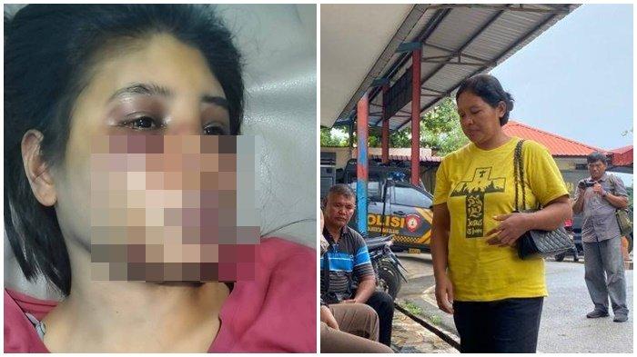 PENGANIAYAAN ART DI BATAM - Intan, ART dianiaya majikan di batam (kiri). Regina (kaos kuning) di Mapolresta Barelang, Senin (23/6/2025). Bibi Intan, seorang ART di Batam asal NTT korban penganiayaan oleh majikan mengungkap cerita pilu selama bekerja selama setahun di salah satu perumahan elite di Batam.